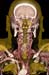 02_HRCarotidCTA