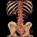 ABDOMEN_VRT