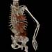 ArmAngiogram