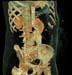 body aorta color