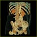 body aorta
