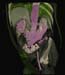 body kidney