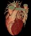 wellness 3d heart