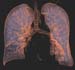 wellness lung