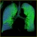 wellness lung1