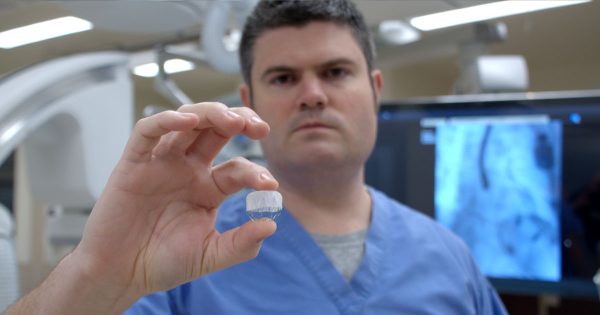 A One-Time Implant Could Reduce Stroke Risk