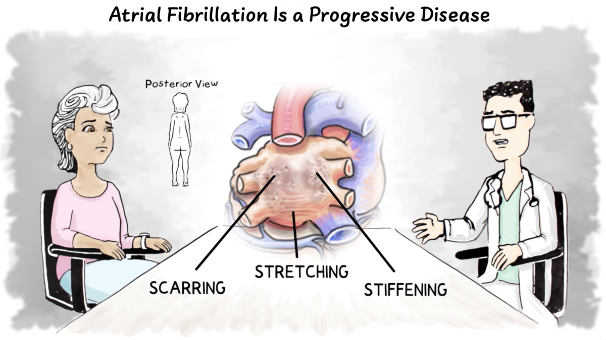 If not treated, more severe Afib can cause scarring, stretching, and stiffening of the heart tissue.
