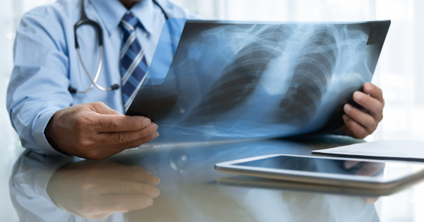 Addressing and Avoiding Asthma Triggers